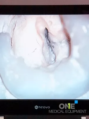 Carl-Zeiss-OPMI-Sensera-AG-Neovo-Monitor