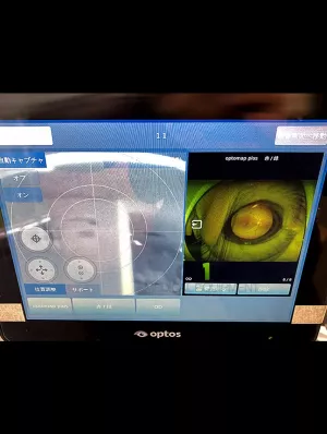 Optos-P200DTx-California-Retinal-Imaging-System